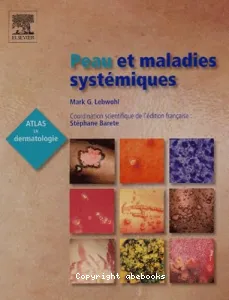 Peau et maladies systémiques