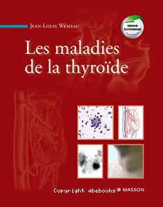 Les maladies de la thyroïde